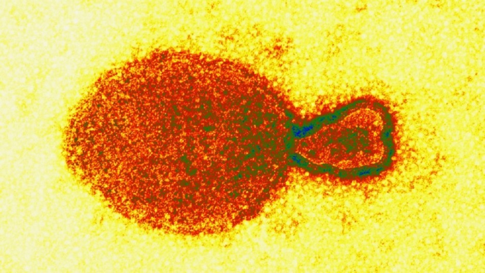 China registra 35 pacientes contagiados con nuevo virus derivado de animales: cuáles son los síntomas | Internacionales