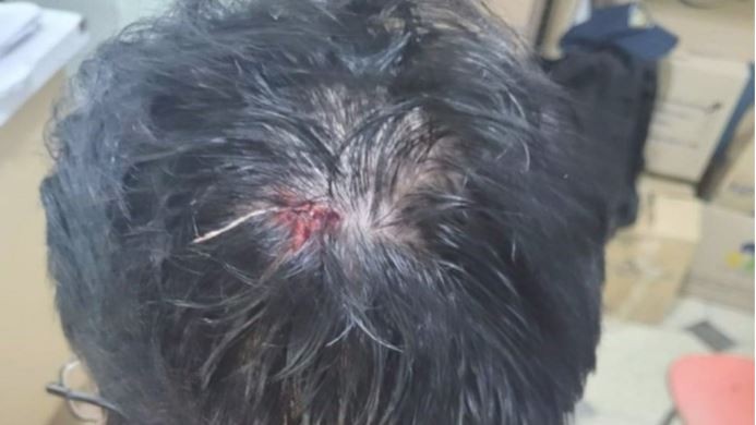 Trelew: un taxista agredió a un operario con una llave de auxilio | Actualidad