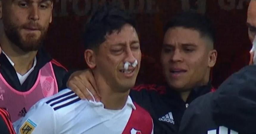 Aliendro recibió el alta: fue operado por la fractura del macizo facial que sufrió en el superclásico | Deportes