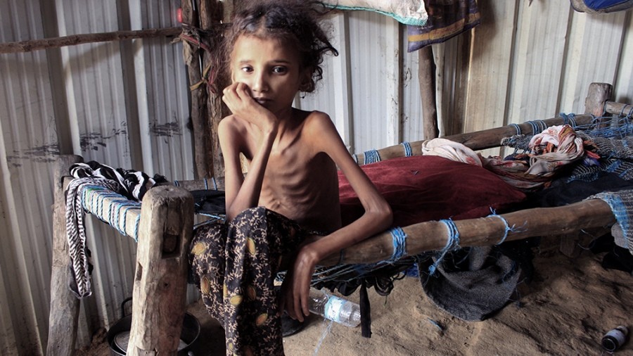 Cada cuatro segundos muerte una persona de hambre en el mundo | Actualidad