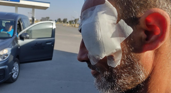 Policía denunciado por el “Negro” Videla fue imputado por lesiones | Córdoba