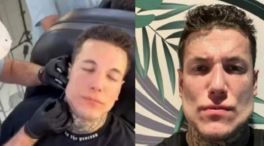 "Me ven en persona y se les cae la bombacha": Alex Caniggia, furioso por las críticas sobre su mandíbula | Espectáculos
