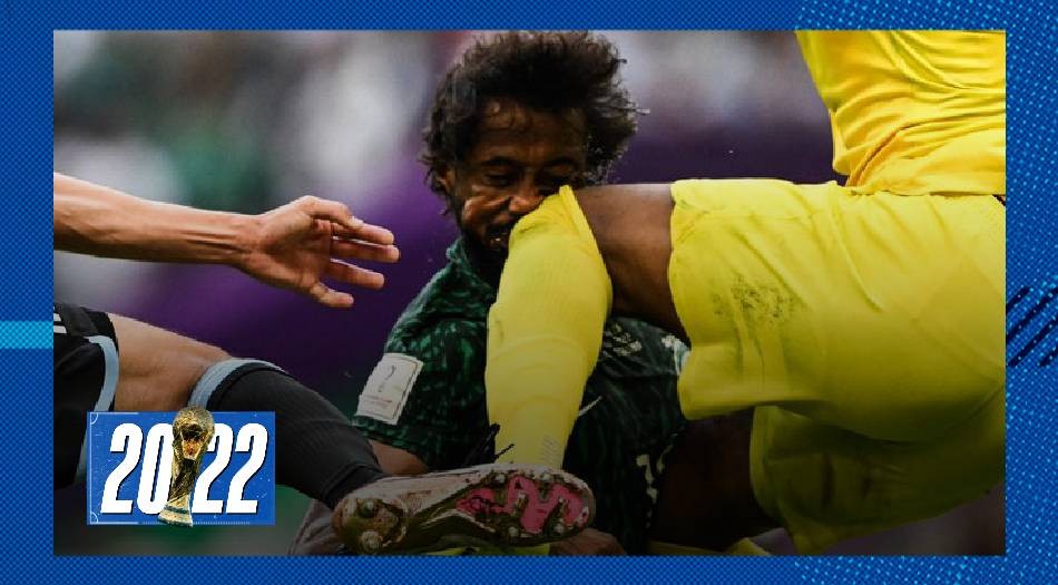 Afuera del Mundial: Al Shahrani sufrió fractura de mandíbula y fue operado | Deportes