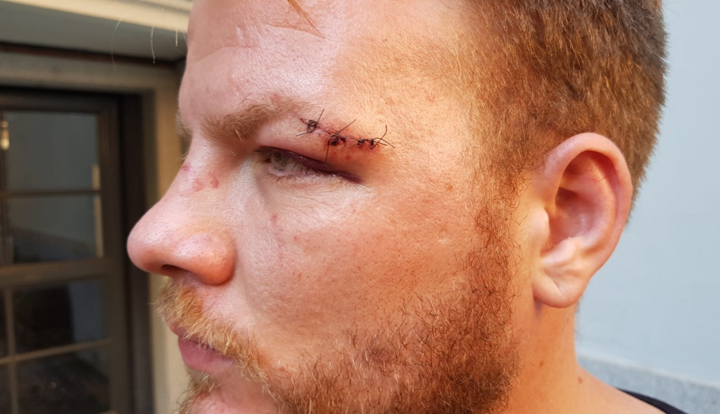 Hay 6 detenidos por el ataque al periodista en Carlos Paz | Córdoba