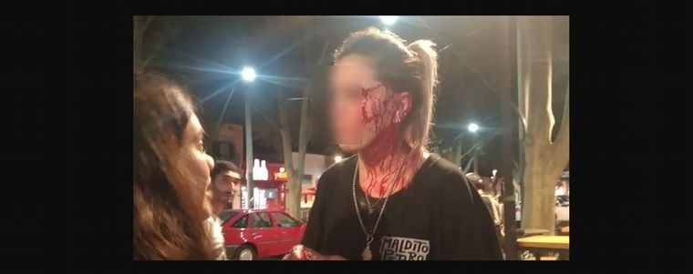 Brutal agresión a una moza con un vaso en un bar de Mendoza: "Me arruinaron" | Actualidad