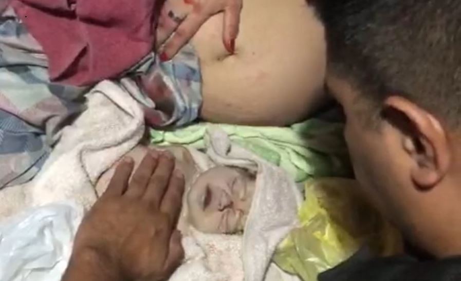 Conmovedor: un policía reanimó a un bebé que había nacido sin signos vitales | Actualidad