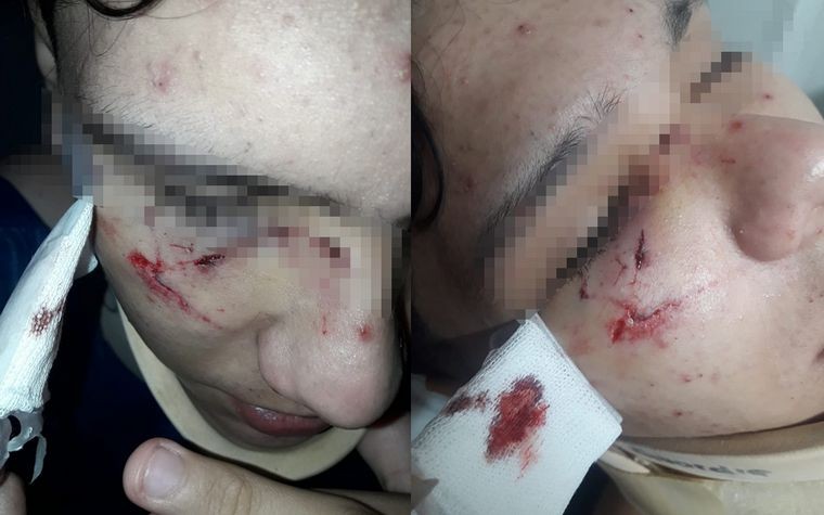 Brutal agresión a joven a la salida de una escuela en Yocsina | Deportes