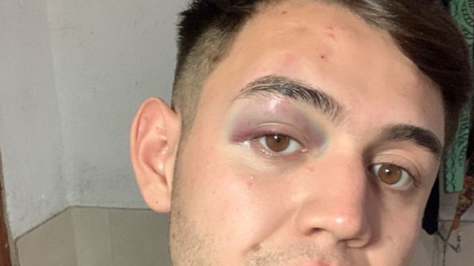 Brutal paliza a un grupo de jóvenes en un boliche de Carlos Paz por personal de seguridad | Actualidad