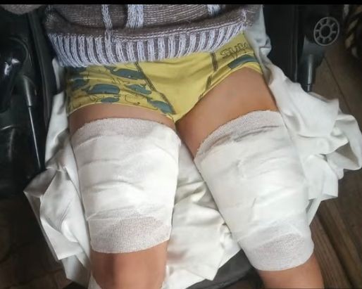 Otra vez un perro peligroso atacó a un menor de edad | Córdoba