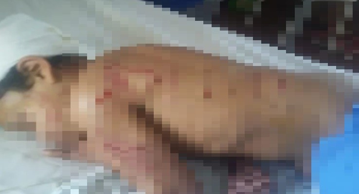 "Pensé que lo mataban": una jauría atacó a un nene de 9 años | Actualidad