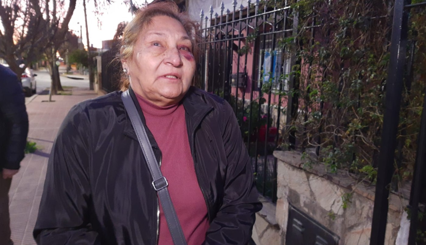 Una anciana se colgó de su auto para que no se lo roben y sufrió varias heridas | Córdoba