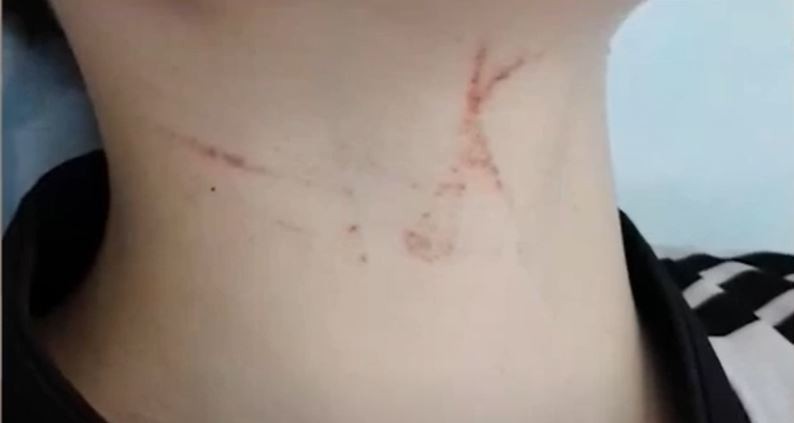 Denuncian bullying contra un niño de 11 años que terminó hospitalizado | Córdoba