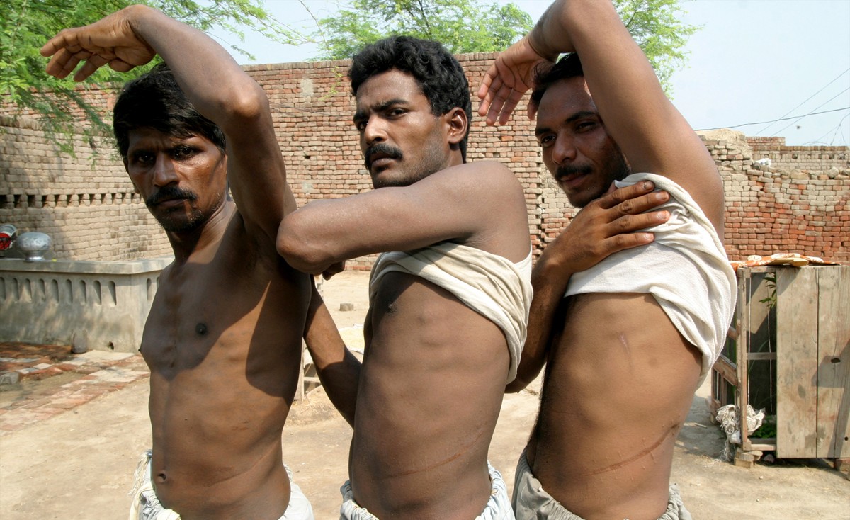 Tráfico de órganos: detienen a una banda que vendió más de 300 riñones humanos en Pakistán | Internacionales