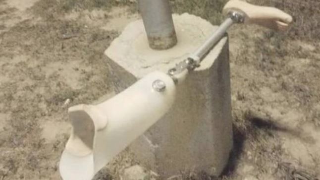 Se emborrachó, perdió su pierna ortopédica y la encontró dos días después | Córdoba