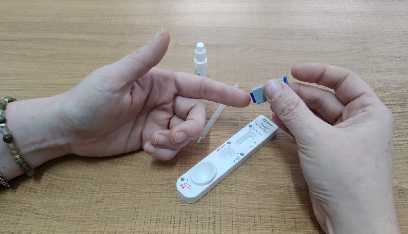 El Laboratorio Central de Córdoba aprobó un autotest de VIH: modo de uso, forma de adquirirlo y precio | Córdoba