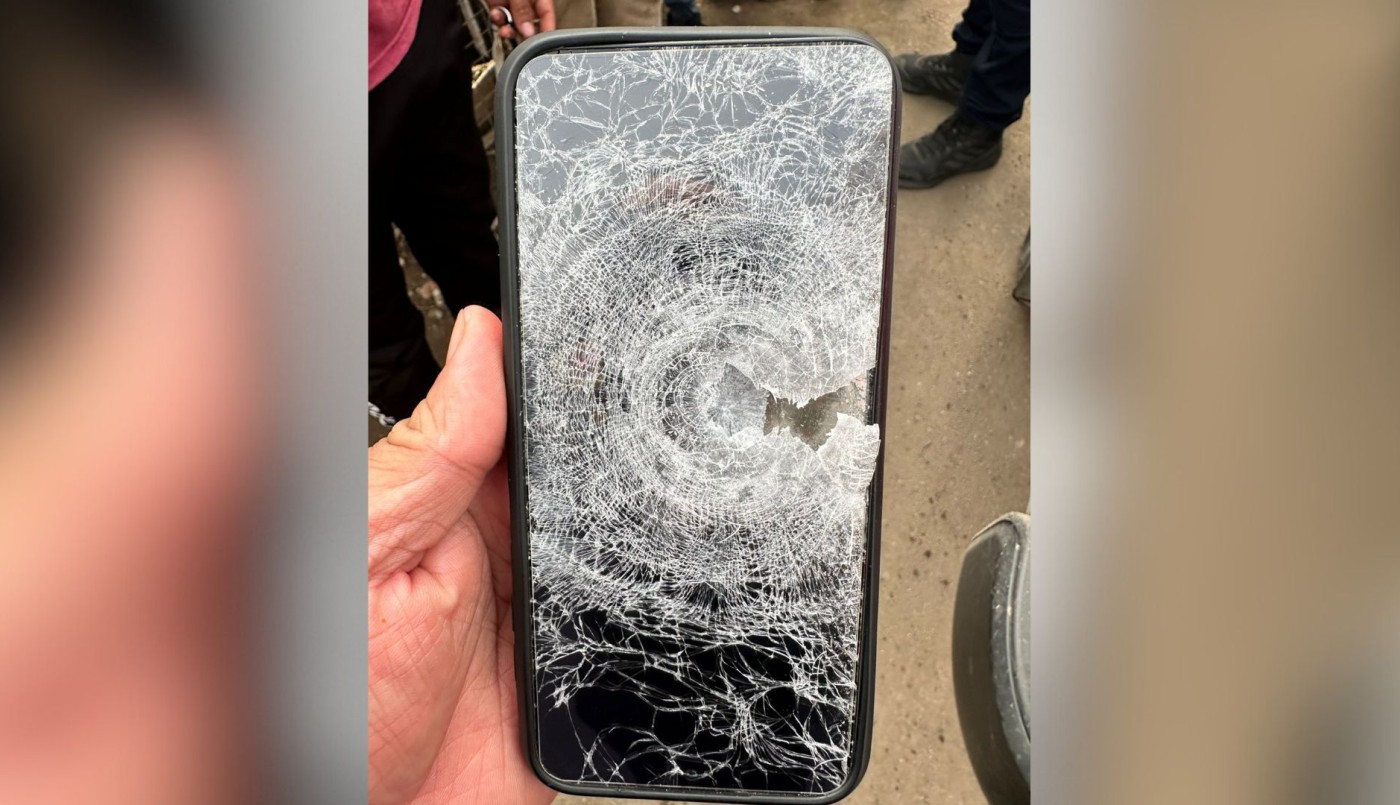 Le dispararon a un joven de 25 años en la pierna y se salvó gracias al celular | Córdoba