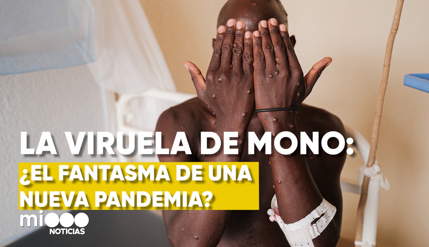Viruela del mono: ¿El fantasma de un nueva pandemia? | VIDEOS TFN CORDOBA