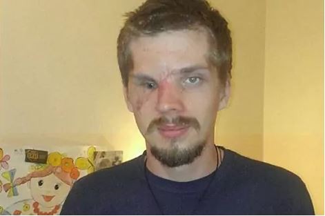 Ucrania: hicieron cirugías estéticas gratuitas a víctimas de la guerra | Internacionales