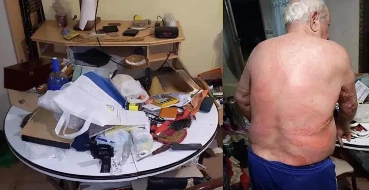 Entradera en Lomas del Mirador: quemaron con agua hirviendo a un abuelo | Actualidad