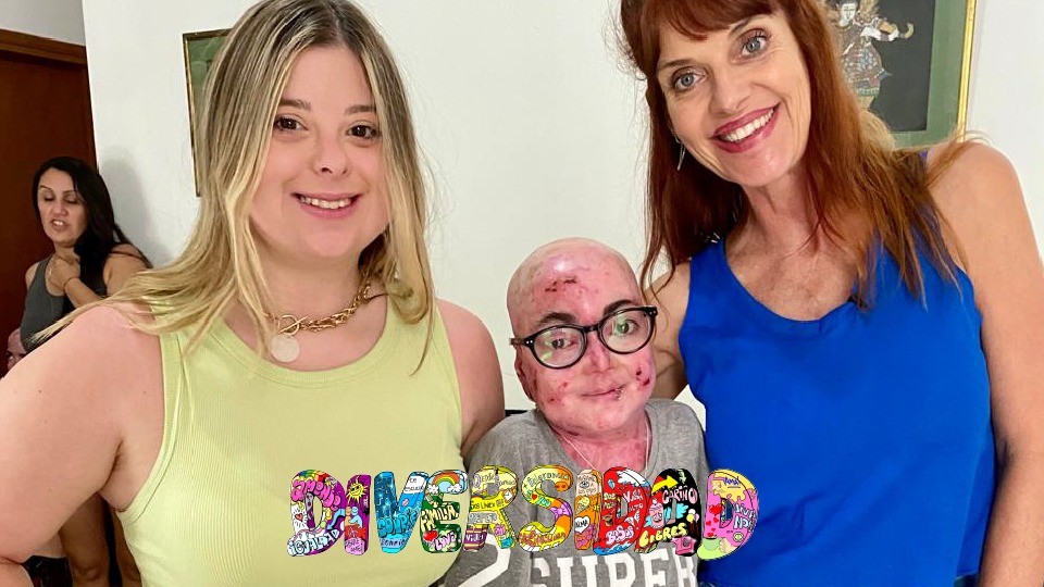 Juli tiktoker con piel de cristal | Diversidad