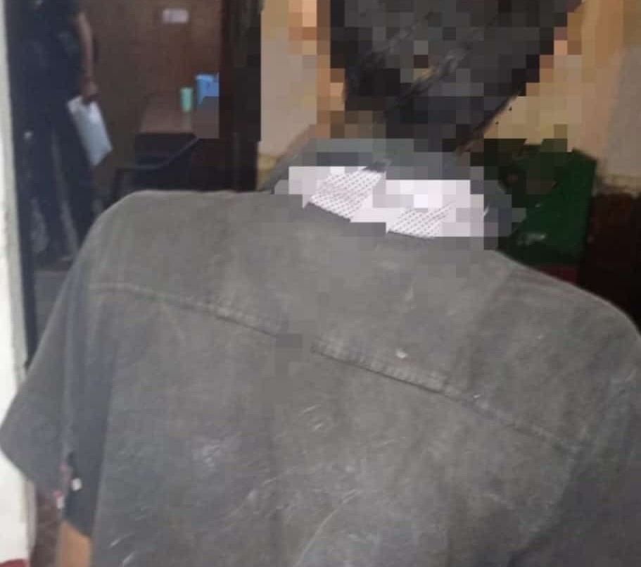 Mordió a un policía cuando intentaba huir tras cometer un robo | Actualidad