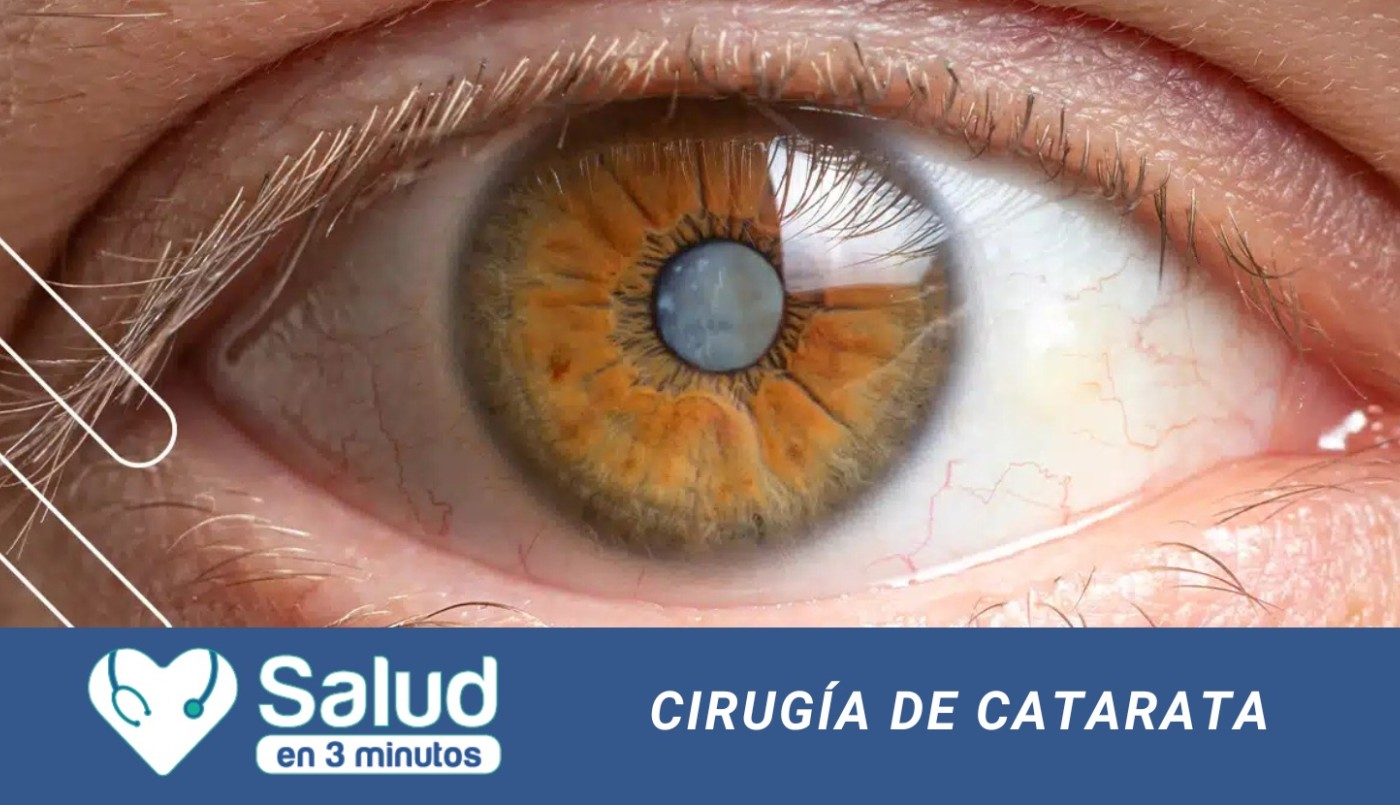 ¿Cuáles son los avances en la cirugía de Catarata? | Salud