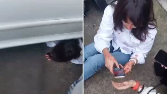 La Plata: una mujer fue atropellada por su propio auto tras olvidar poner el freno de mano | Actualidad