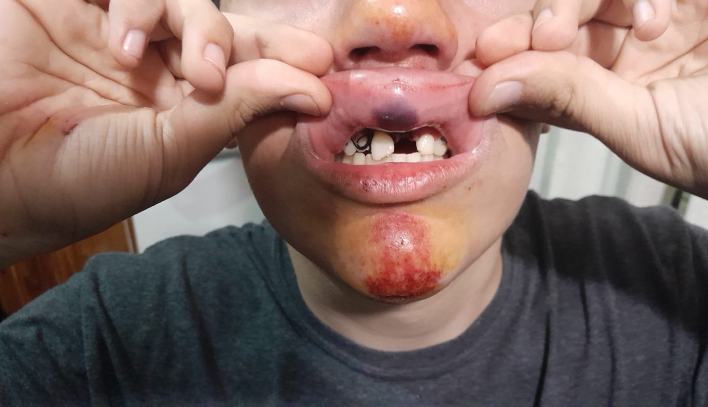Iba a comprar y lo empujaron para robarle: perdió dos dientes | Córdoba