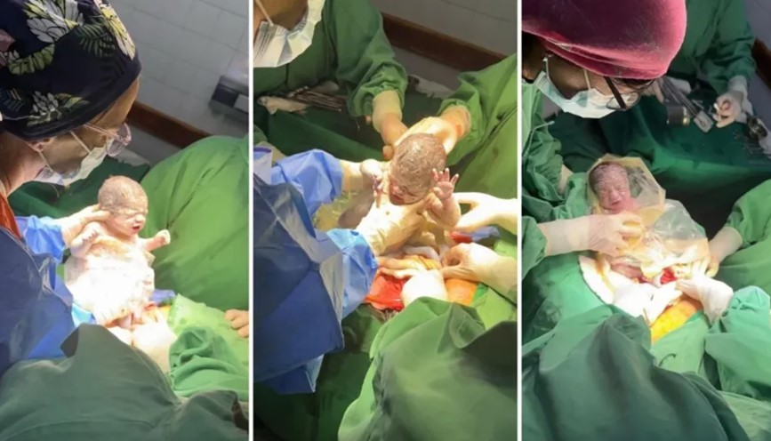 Un caso que sucede cada un millón: nacieron trigemelas en Salta | Actualidad