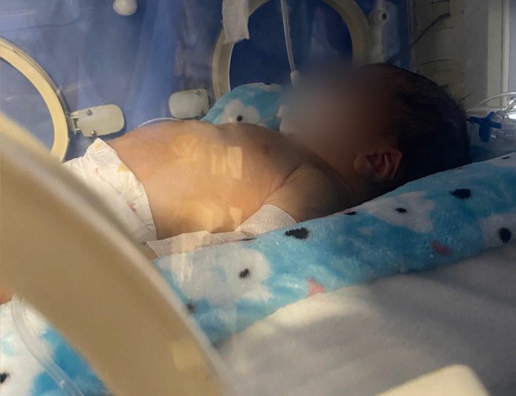 Recibió el alta el bebé que luchó cinco meses tras ser afectado por fentanilo contaminado | Córdoba