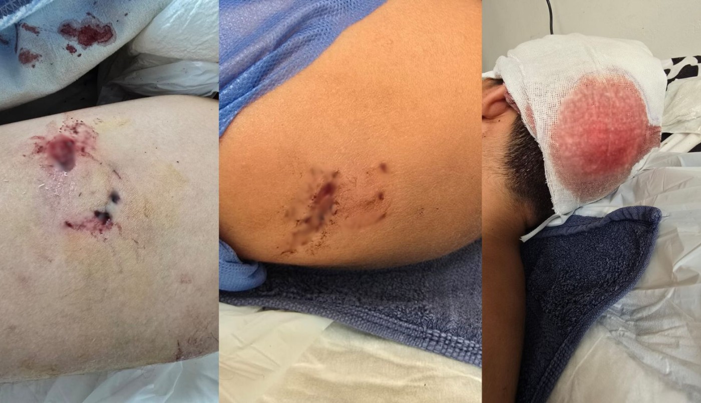 Un niño fue atacado por un pitbull en B° Los Boulevares y terminó hospitalizado | Córdoba