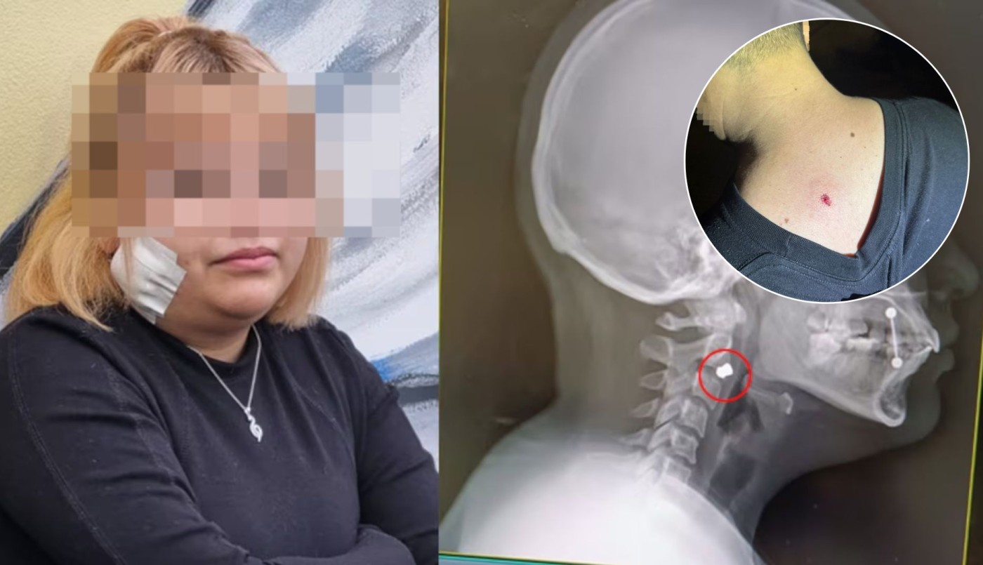 Francotiradores en Plaza España: hirieron a varios jóvenes desde un edificio | Córdoba