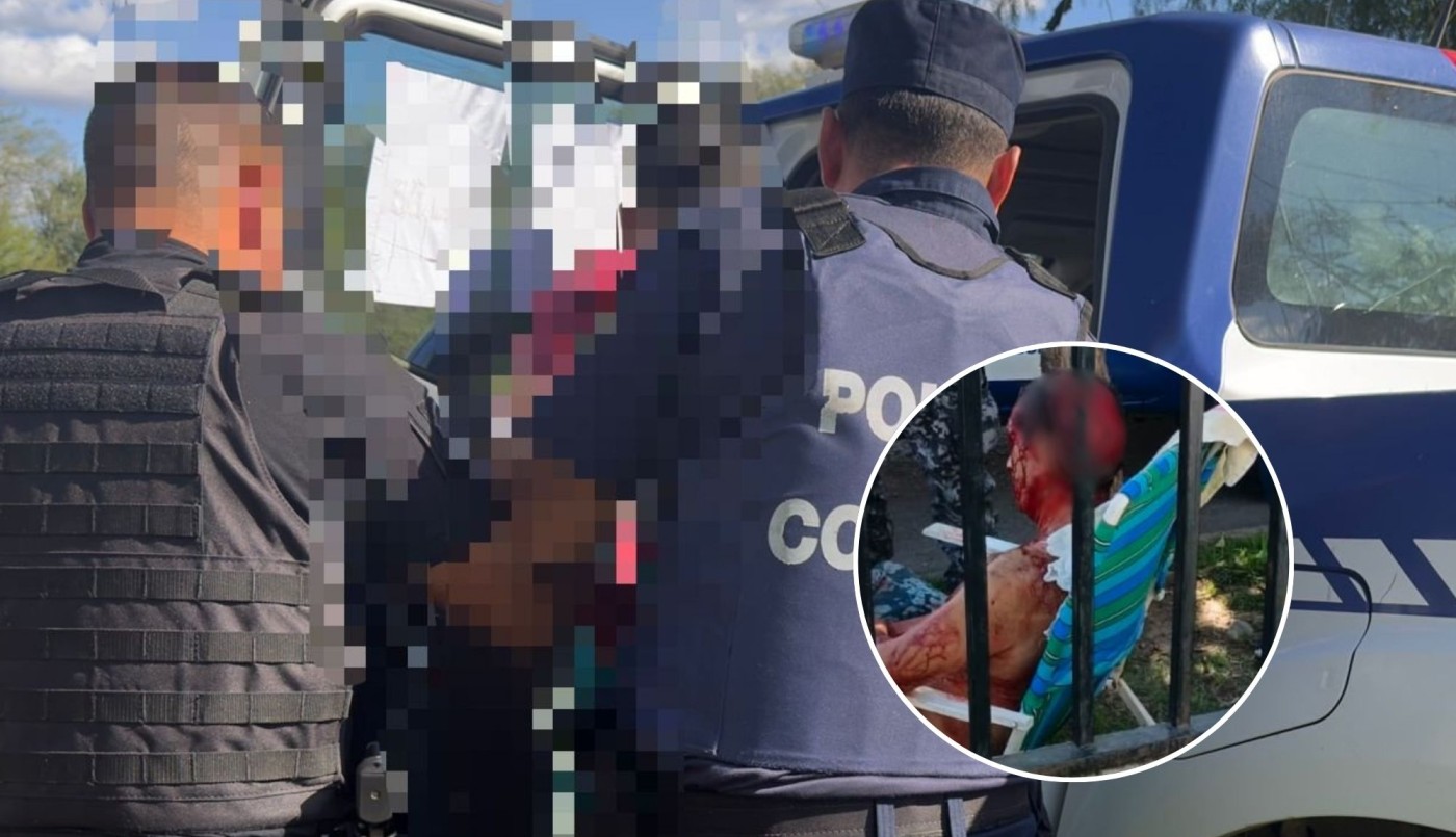 Perro ataca a un hombre y le provoca heridas de gravedad en el barrio de Villa Adela | Córdoba