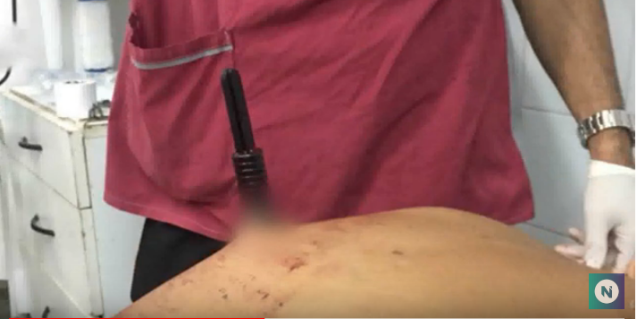 Ladrón apuñalado por dos mujeres en un asalto en Barrio Yofre Sur | Córdoba