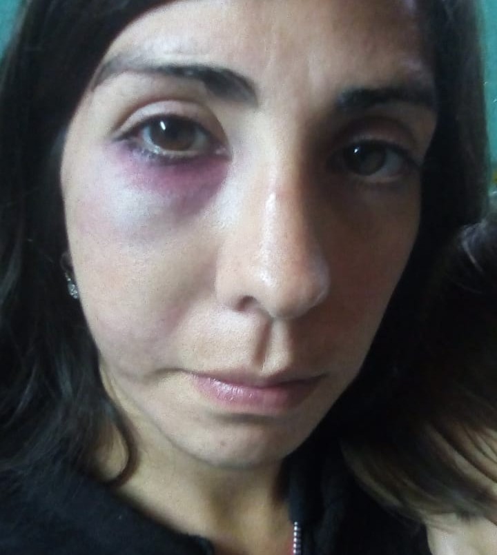 Su novio la golpeó, perdió un embarazo y murió: la lucha de la familia para que reconozcan el femicidio | Actualidad