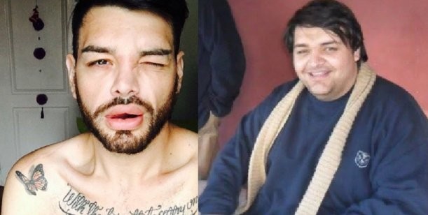 El joven que se operó 27 veces para parecerse a Ricky Martin | Curiosidades