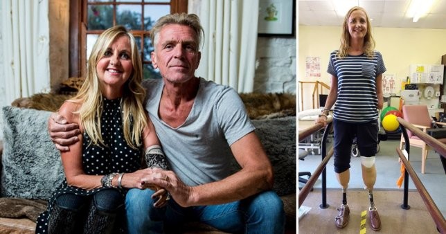 Fue al médico por una tos: le tuvieron que amputar las piernas y un brazo | Internacionales