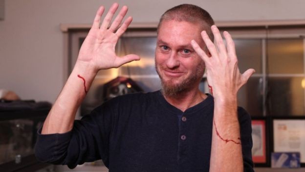 El joven que se dejó morder por 200 serpientes venenosas en busca del antídoto universal | Curiosidades