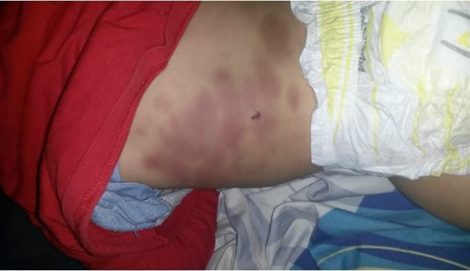 Imputan a la mamá de un bebé y a su pareja por golpearlo y fracturarle una costilla | Córdoba