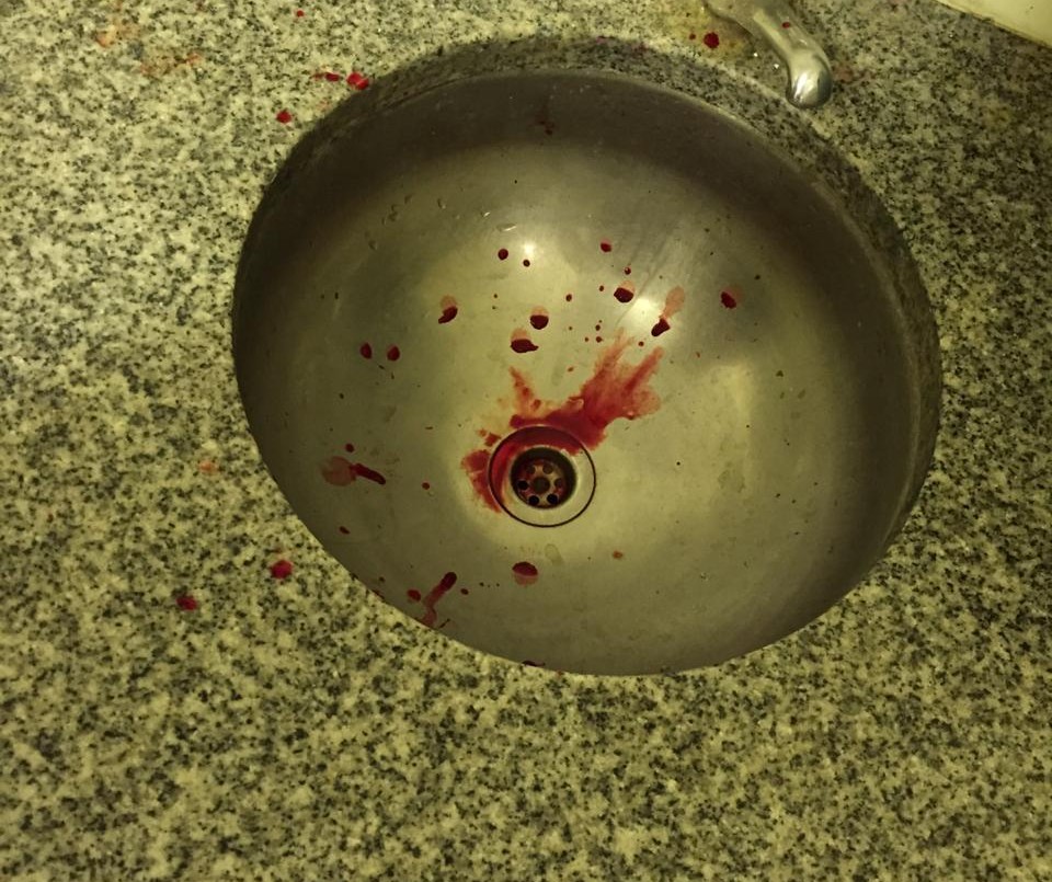 Alerta en La Plata: dos alumnos se contagiaron tuberculosis | Actualidad