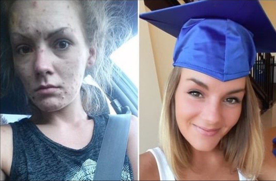 El antes y el después: mostró fotos a 2 años de empezar su recuperación de las drogas | Internacionales