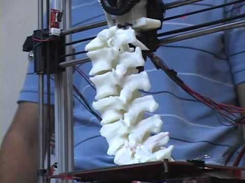 Científicos argentinos desarrollan "huesos" con impresoras 3D | Actualidad