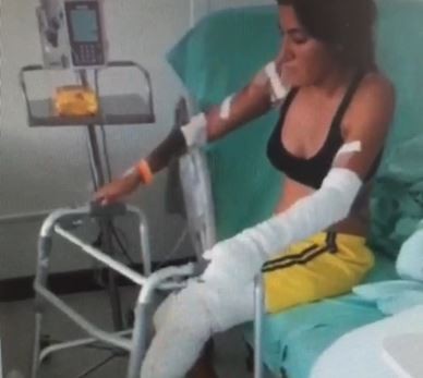 Turista argentina se quemó en Colombia: hacen colecta para su tratamiento médico | Actualidad