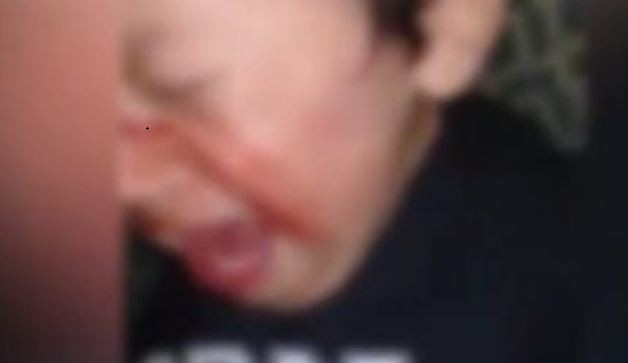 Una madre le fracturó el cráneo a su hijo de 7 años porque gastó dinero en golosinas | Actualidad