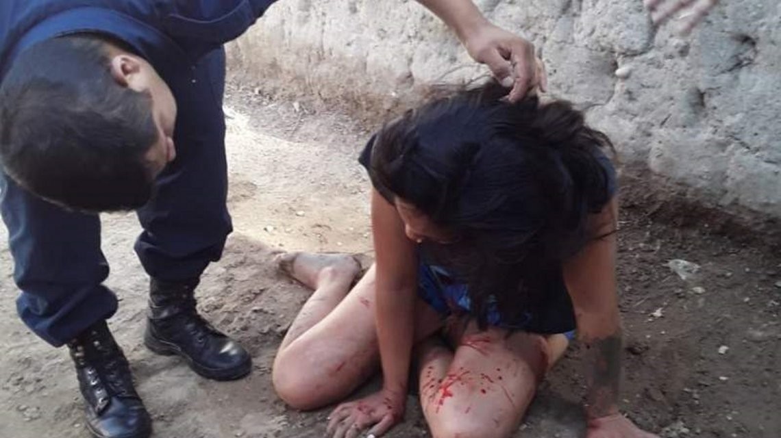 Golpeó a su mujer hasta dejarla inconsciente y se escapó | Actualidad