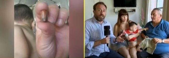 Un bebé fue herido con una bala perdida y los médicos le dijeron que un perro lo había mordido | Actualidad