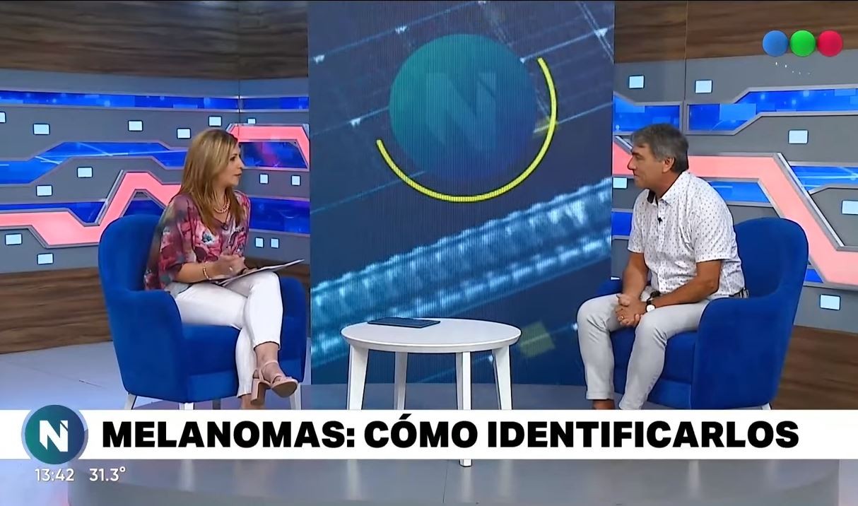 LUNARES PELIGROSOS: todo lo que hay que saber sobre la prevención del cáncer de piel o melanoma | Columnistas