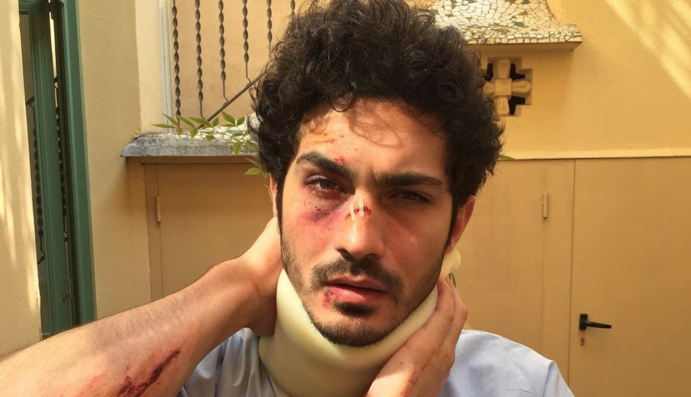 La foto del Chino Darín que preocupó a sus seguidores | Espectáculos