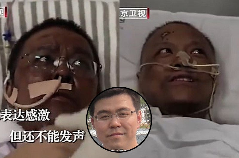 El sorpresivo cambio de color de piel de dos médicos que se recuperan de coronavirus en Wuhan | Internacionales