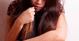 EE.UU. prohibió el uso de dispositivos eléctricos para tratar comportamientos autolesivos | Internacionales